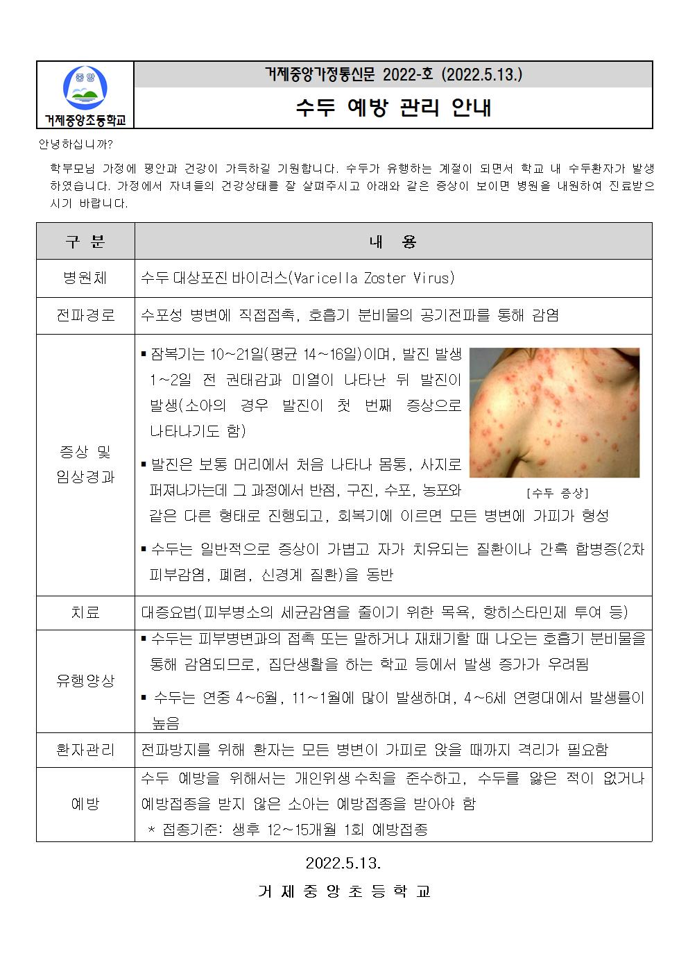 수두예방관리001.jpg