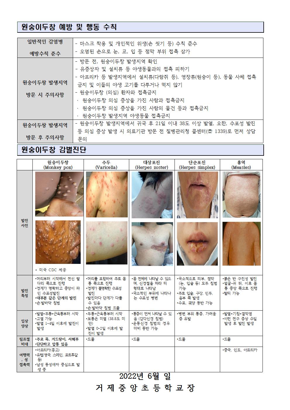 원숭이두창 관심단계 안내002.jpg